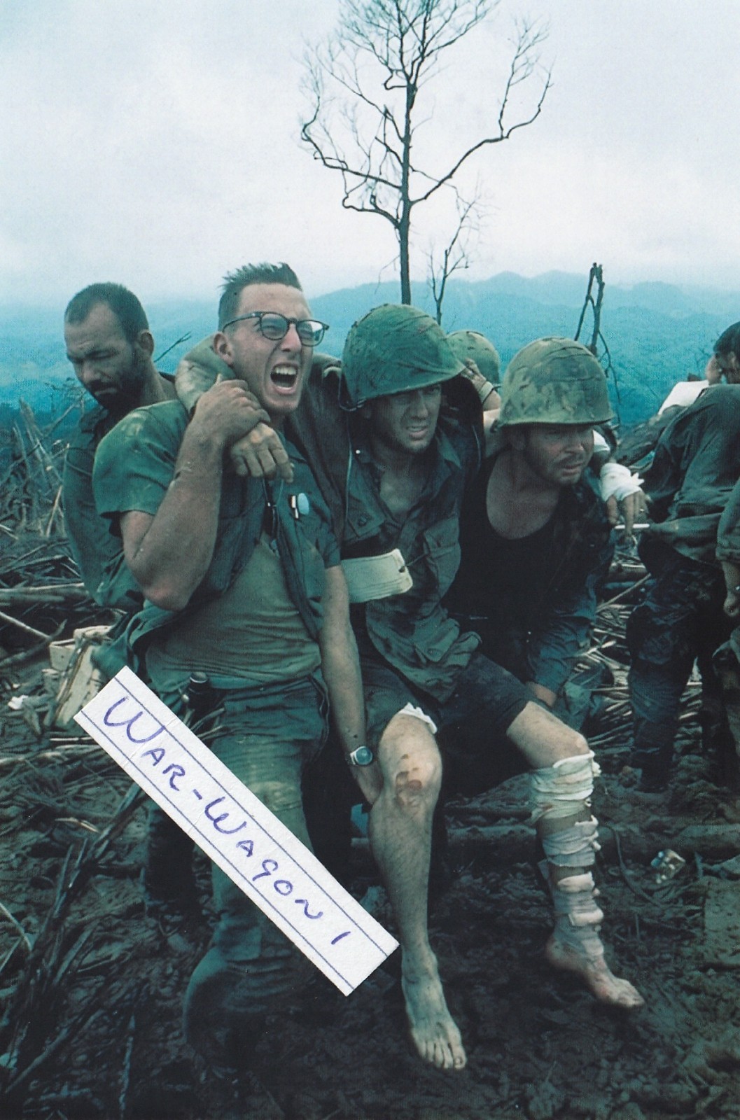 Vietnam War Photos — Wounded soldier